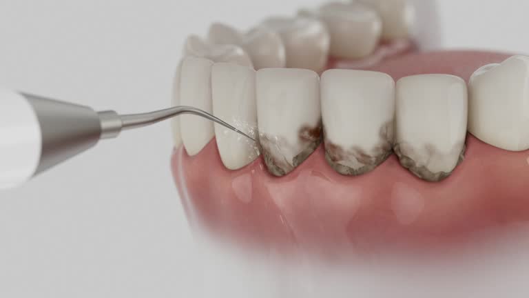 Reliable Dental Implants contractor in DeWitt, IA by Smile Center Dentistry